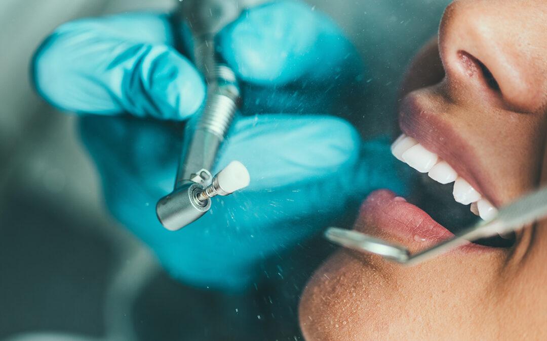 Todo lo que debes saber sobre la limpieza dental profesional